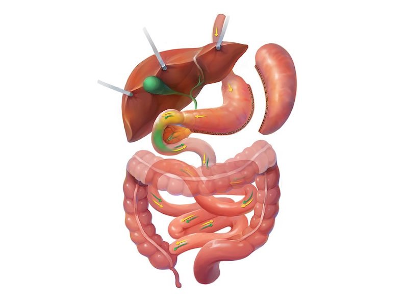 >The Procedures: Sleeve vs. Bypass